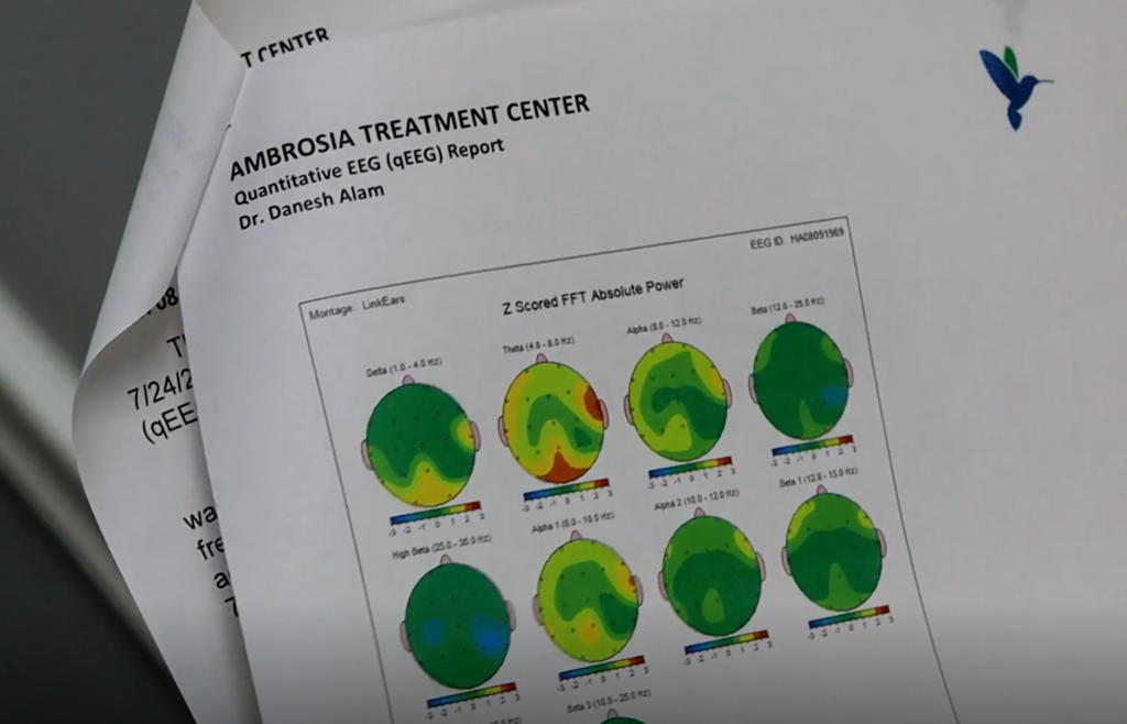 Brain mapping, clinical trials and research studies at NRI, Ambrosia Behavioral Health